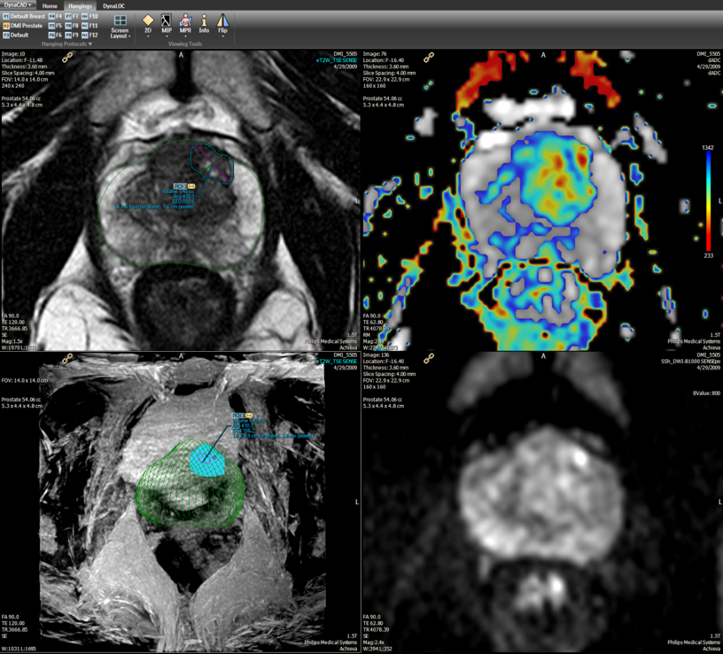 Multiparametric Mri Definition At Joel Hudak Blog Multiparametric Mri Definition At Joel Hudak Blog